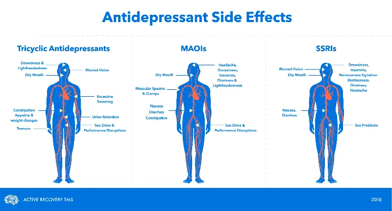 Buy Prozac, buy paxil , buy zoloft, Depression treatment, buy Antidepressants , Antidepressants.  