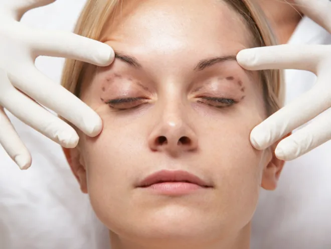 After Blepharoplasty is done, a doctor suggests some eye care that needs to be followed properly. 